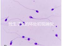 獨生子女的壞處初現端倪，贍養父母已成難題