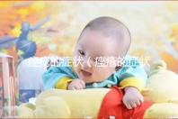 痤瘡的癥狀（痤瘡的癥狀表現(xiàn)有哪些）