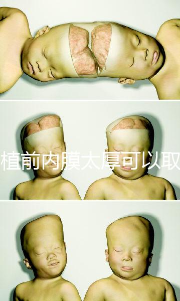 移植前內膜太厚可以取卵早知道，疼痛因人而異