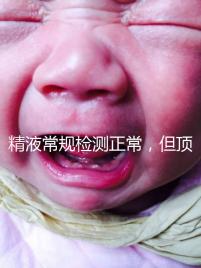 精液常規(guī)檢測正常，但頂體酶低，是否影響試管嬰兒成功率？