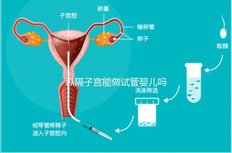 縱隔子宮能做試管嬰兒嗎?醫生:可以做，但要手術治療再進周