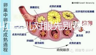 糾正嬰兒對(duì)眼先別著急，眼科醫(yī)生教你3招鑒別法