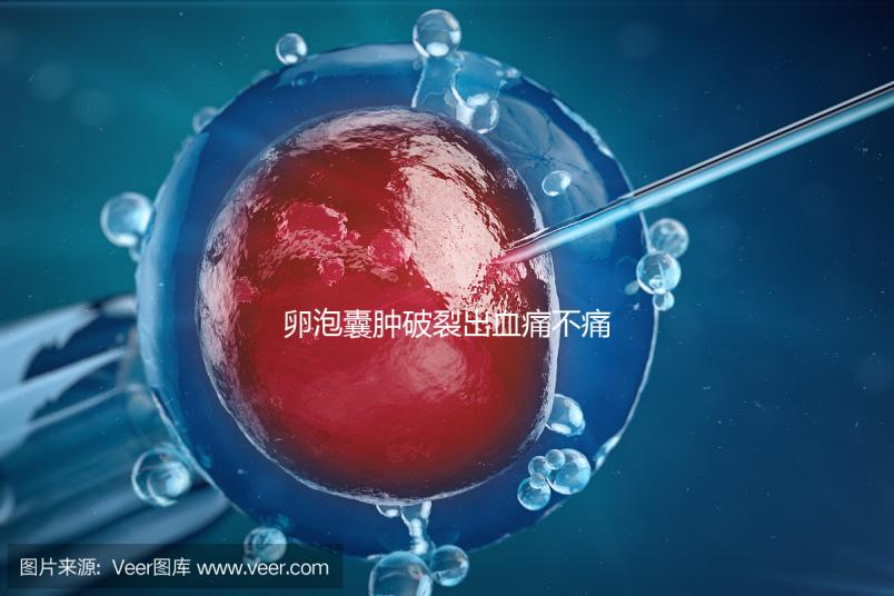 卵泡囊腫破裂出血痛不痛？經歷過的姐妹們給出回應