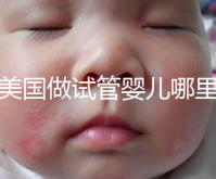 去美國做試管嬰兒哪里最好，4家好評輔助生殖機構(gòu)推薦