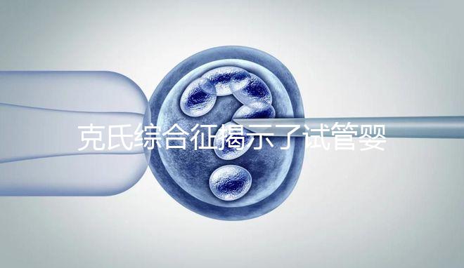 克氏綜合征揭示了試管嬰兒的最佳年齡大于這個年齡要注意