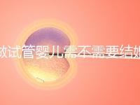 做試管嬰兒需不需要結(jié)婚證