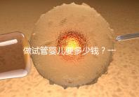 做試管嬰兒要多少錢？一起算筆經濟賬