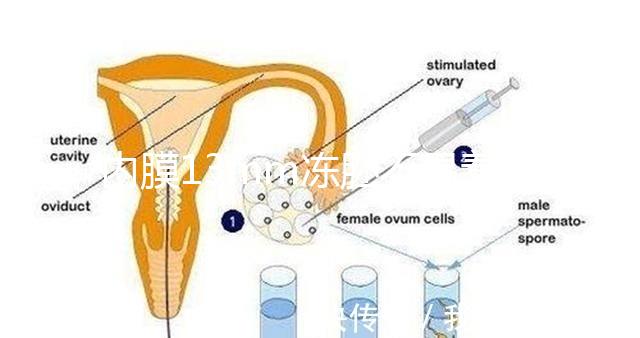 內(nèi)膜13mm凍胚不易著床要注意，移植與否看醫(yī)生怎么說