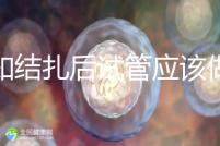 告知結扎后試管應該做什么準備，是否有照片檢查，有答案