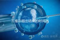 二維彩超出結(jié)果的時間并不長,從檢查流程便可看出