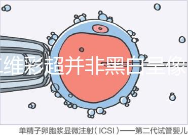 二維彩超并非黑白呈像，通過檢查還能看清胎兒五官