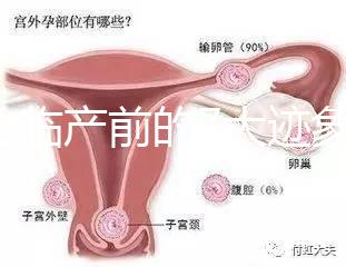 二胎臨產前的7大跡象，出現見紅、陣痛別大意