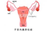 產后喝生化湯排惡露會使寶寶拉肚子？醫生：時間沒用對