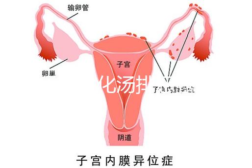 產后喝生化湯排惡露會使寶寶拉肚子？醫生：時間沒用對