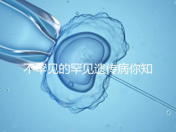 不罕見的罕見遺傳病你知道嗎？帶你認(rèn)識下特納綜合癥