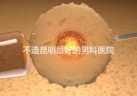 不造昆明最好的男科醫(yī)院是哪一家？中南醫(yī)院價格低了解下