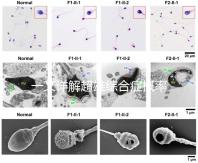 一文詳解超雄綜合癥概率有多大，想造的人多不多看過來