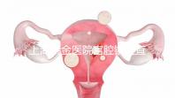 上海瑞金醫(yī)院宮腔鏡檢查多少錢？專家：流程簡(jiǎn)單性價(jià)比高