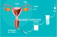 上海結婚落戶政策即將到來,包括2024年黃浦區(qū)詳細的戶籍流程