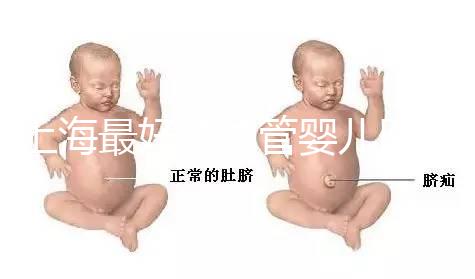 上海最好的試管嬰兒醫(yī)院信息匯總,想要最權(quán)威真得看這幾家