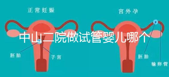 中山二院做試管嬰兒哪個醫生好?附醫院試管成功率