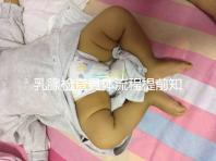 乳腺檢查具體流程提前知曉,看完就診時(shí)不再尷尬