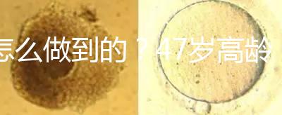 怎么做到的？47歲高齡試管嬰兒唯一男胚一次移植成功！