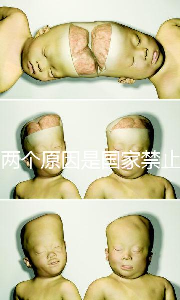 有兩個(gè)原因是國家禁止中非混血中國會接受嗎?