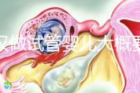 武漢做試管嬰兒大概要多少錢?