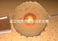 武漢同濟(jì)醫(yī)院采精手術(shù)費(fèi)用分析，顯微采精也可報銷