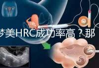 夢美HRC成功率高？那是因為有這些試管嬰兒醫生