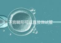 子宮畸形可以直接做試管嬰兒?醫(yī)生說(shuō),應(yīng)先治療!