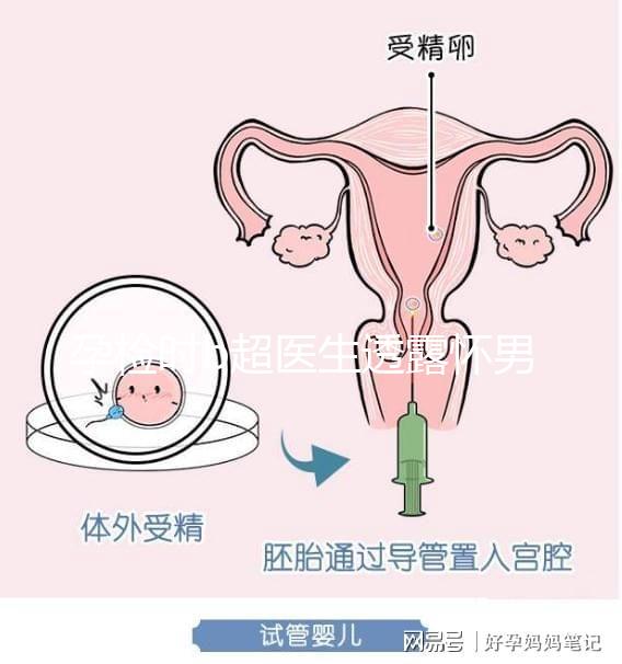 孕檢時b超醫生透露懷男寶女寶暗語寶典，一語戳中有心人！