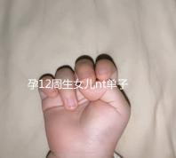 孕12周生女兒nt單子特征真不少,圖上早已告知胎兒性別真相