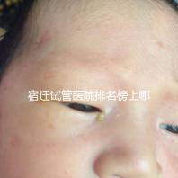 宿遷試管醫院排名榜上哪家好，不造助孕成功率和費用別亂選