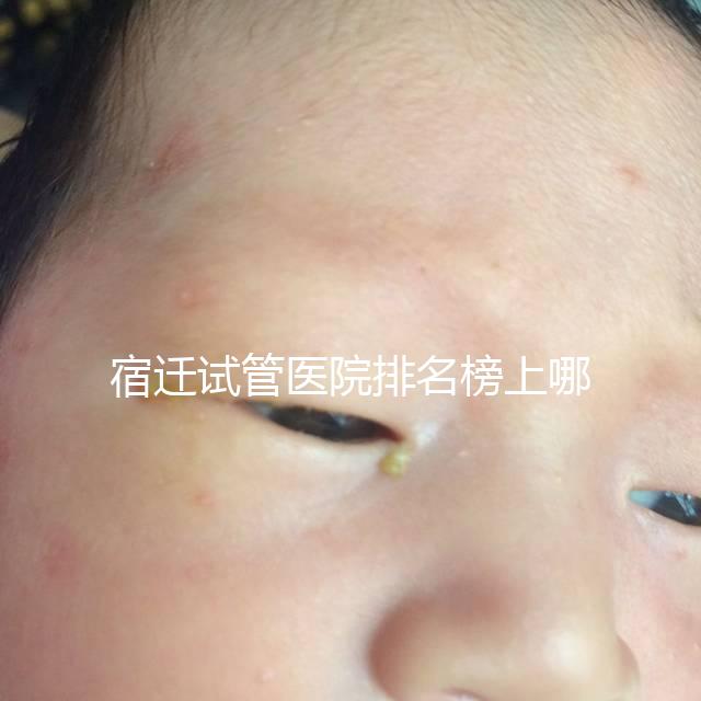 宿遷試管醫院排名榜上哪家好，不造助孕成功率和費用別亂選