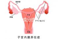 寶寶金水成分由這4種中藥材構(gòu)成,對(duì)寶寶有益無(wú)害