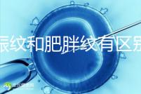 妊娠紋和肥胖紋有區(qū)別，教你3種“花紋”診斷鑒別的方法