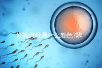 妊娠月經是什么顏色?辨別其與月經區別3大要素之一