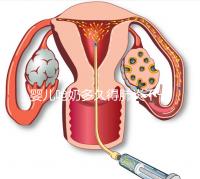 嬰兒嗆奶多久得肺炎不一定，這8個早期癥狀可助你判斷