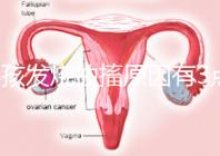 小孩發(fā)燒抽搐原因有3點(diǎn),急救很關(guān)鍵!