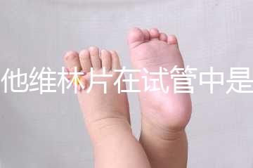 屈他維林片在試管中是否有副作用,導(dǎo)致胎停不是空穴來(lái)風(fēng)