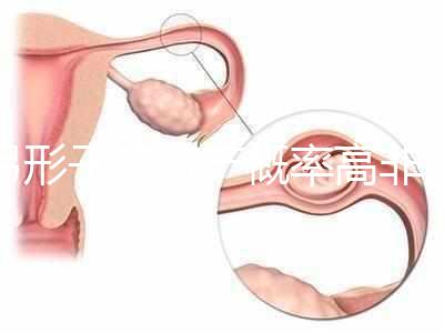 弓形子宮流產概率高非個例!罪魁禍首是這個原因