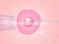 干貨!烏克蘭試管嬰兒移植后注意這些事項,輕松提高30%成功率