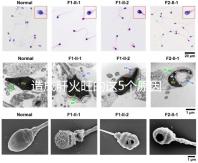 造成肝火旺的這5個(gè)原因,你都知道嗎?