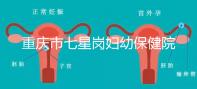 重慶市七星崗婦幼保健院做試管需要多少錢?可以用醫(yī)療保險嗎?