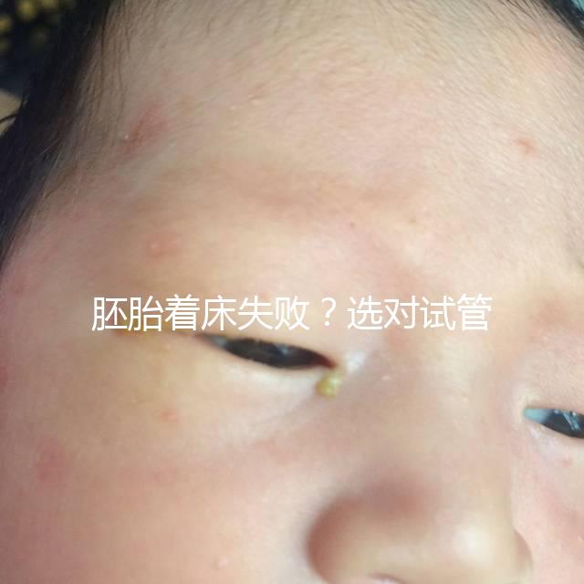 胚胎著床失??？選對試管嬰兒醫生很重要