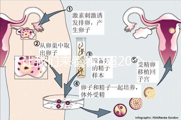 讓我們來看看b超20個卵子取10個是不正常的我們該怎么辦？