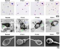 西華做試管嬰兒費用-西華醫(yī)院試管嬰兒花費明細表