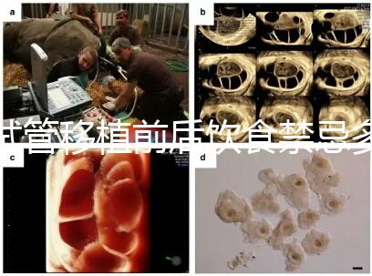 試管移植前后飲食禁忌多，十大不利于胚胎著床的水果別亂吃